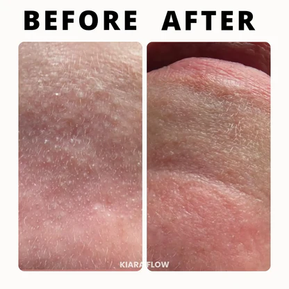 KIARA FLOW RiceShot™ Duo Exfoliator